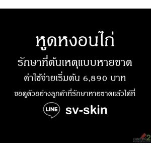 หูดหงอนไก่ เสี่ยงเป็นมะเร็งในช่องปาก มะเร็งในลำคอ มะเร็งทวารหนัก LINE: sv-skin
