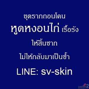 หูดหงอนไก่ โรคติดต่อทางเพศสัมพันธ์ที่มาพร้อมความเครียดและวิธีจัดการให้สิ้นซาก