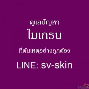 เผยปัจจัยกระตุ้น ไมเกรน ตัวการร้ายทำลายสมองและสร้างความทรมานให้ร่างกาย