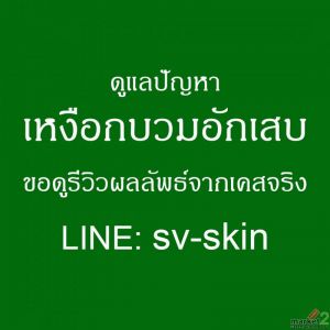 มีหนองไหลตามซอกฟัน เจ็บระบมตอนขบเคี้ยว ถลกเบื้องหลังโรค เหงือกอักเสบเรื้อรัง
