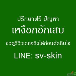 จากเหงือกบวมสู่โรคหัวใจ! ภาวะแทรกซ้อนอันตรายของ โรคเหงือกอักเสบเรื้อรัง