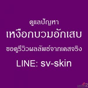 บอกลากลิ่นปากเหม็นเรื้อรัง! ยุติวงจร โรคเหงือกอักเสบเรื้อรัง ก่อนที่จะต้องใส่ฟัน