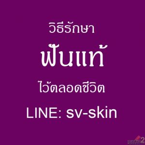 เสี่ยงฟันโยก รากฟันผุ จากภาวะ โรคเหงือกอักเสบเรื้อรัง