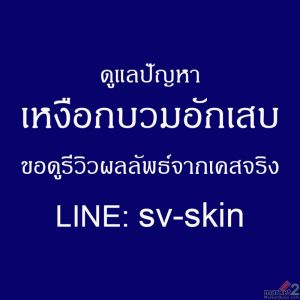 โรคเหงือกอักเสบเรื้อรัง ตัวการร้ายทำลายกระดูกขากรรไกรและสูญเสียฟัน