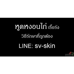 สังเกตอาการ หูดหงอนไก่ ในผู้ที่มีภูมิคุ้มกันบกพร่อง อันตรายกว่าที่คิด