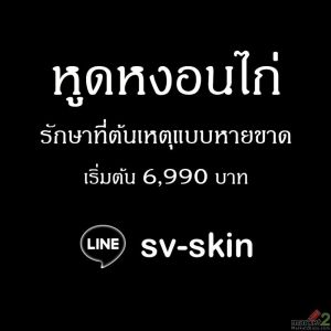หลุดพ้นจากวงจรร้าย! หูดหงอนไก่ อย่าให้การรักษาผิดวิธีทำให้อาการหนักกว่าเดิม
