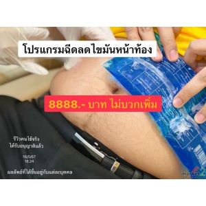 แฟตสลายไขมันหน้าท้อง