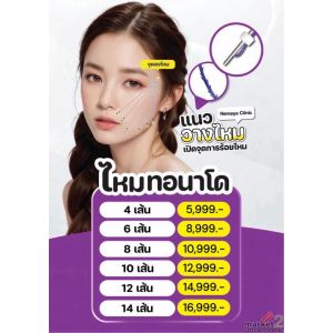 ร้อยไหมทอนาโด ร้อยยกกระชับ