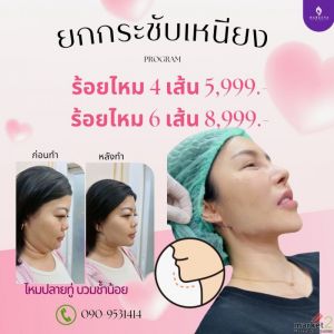 ร้อยไหมยกกระชับเหนียง