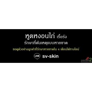 #เริมผิวหนัง #เริมที่ปาก #เริมอวัยวะเพศ รักษาที่ต้นเหตุอย่างได้ผล LINE: sv-skin