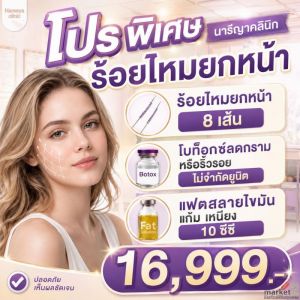 โปรเชต หน้าเรียว หน้าวี ลดเหนียง