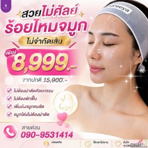 ร้อยไหมจมูกไม่จำกัดเส้น