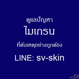แสงจ้า กลิ่นฉุน ชนวนเหตุ "ไมเกรน" กำเริบเฉียบพลัน คุมปัจจัยกระตุ้นอย่างไร