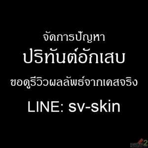 ช่องว่างระหว่างฟันกว้างขึ้น มีสามเหลี่ยมสีดำ? เตือนภัย ปริทันต์อักเสบ