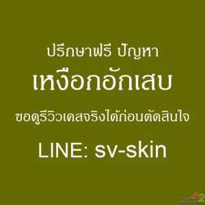 ไม่อยากใส่ฟันปลอมตอนแก่? รีบจัดการ ปริทันต์อักเสบ ก่อนสายเกินแก้