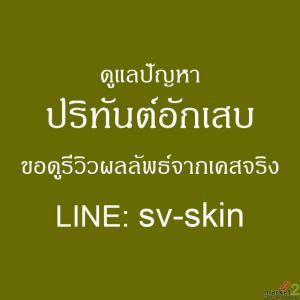 สามเหลี่ยมสีดำระหว่างซอกฟัน สัญญาณอันตรายจาก "ปริทันต์อักเสบ" ที่คุณไม่ควรละเลย