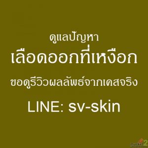 ความเชื่อมโยงระหว่าง "ปริทันต์อักเสบ" กับโรคเบาหวานและหลอดเลือดหัวใจที่ต้องระวัง