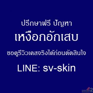 บอกลาภาวะเหงือกร่นจาก "ปริทันต์อักเสบ" คืนรอยยิ้มที่มั่นใจและฟันแท้ที่แข็งแรง