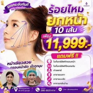 ร้อยไหมยกกระชับหน้าวีเชฟ 10 เส้น