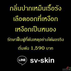 ไขปริศนากลิ่นปากรุนแรง สัญญาณเตือนจาก เหงือกอักเสบเรื้อรัง หลายคนประสบปัญหากลิ่น