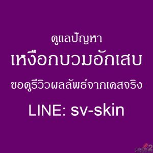 เหงือกอักเสบเรื้อรัง อันตรายเงียบที่ส่งผลกระทบต่อสุขภาพสมอง