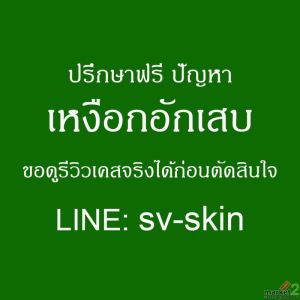 เหงือกอักเสบเรื้อรัง ภัยแฝงที่อาจทำลายดวงตาและการมองเห็น 