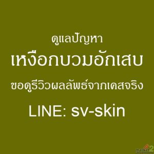 เจาะลึกข้อจำกัดของการขูดหินปูน เมื่อต้องรับมือกับ เหงือกอักเสบเรื้อรัง
