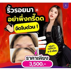 ริ้วรอยเยอะไม่ต้องกังวลอีกต่อไป