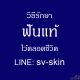 ระวัง! "โรคเหงือกอักเสบเรื้อรัง" ลุกลามสู่รากฟันผุและฟันโยกคลอน