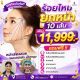 ร้อยไหมยกกระชับหน้าวีเชฟ 10 เส้น