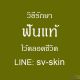 สี่ยงสูญเสียฟันแท้ถาวร ผลกระทบหนักจาก เหงือกอักเสบเรื้อรัง