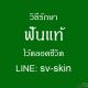 จาก เหงือกอักเสบเรื้อรัง ลุกลามสู่ภาวะรากฟันผุและฟันโยก